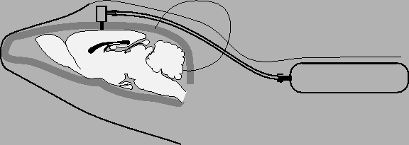 \includegraphics{pompes.eps}